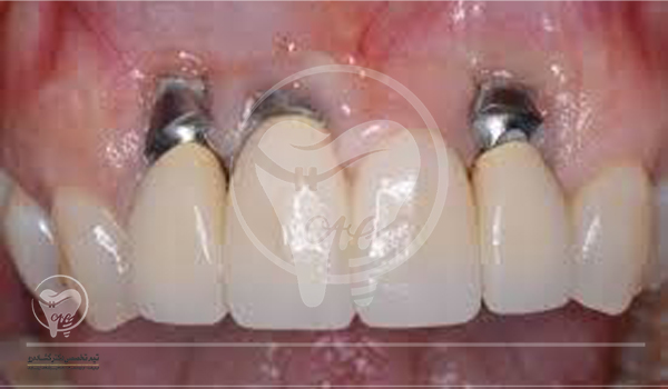 چگونه باید از تخصص یک دندانپزشک در این باره آگاه شد؟